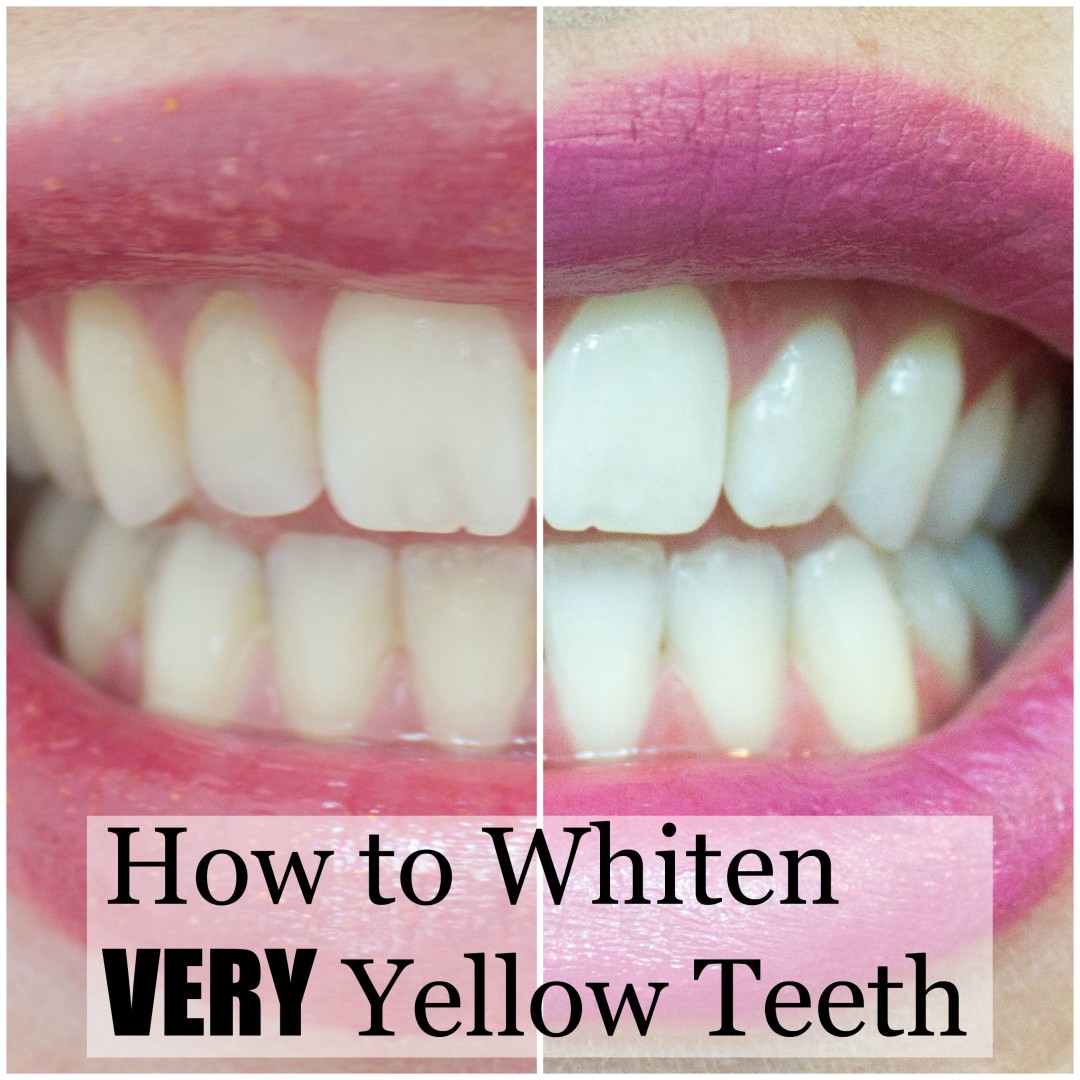 how do you get rid of yellow teeth at home