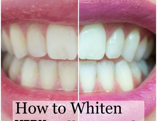How to whiten very yellow teeth